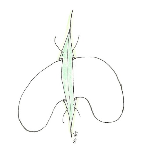 adding ss pockets drawing 3