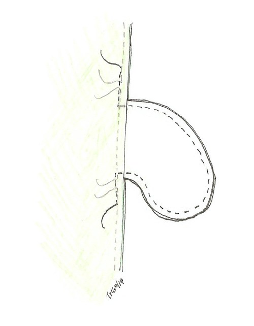 adding ss pockets drawing 4